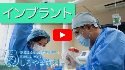 インプラントについて