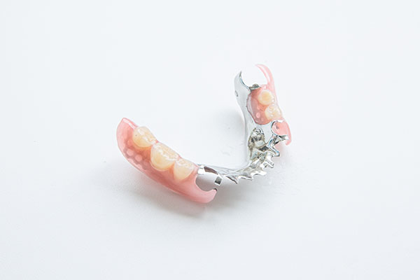 金属床義歯の写真