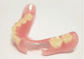 ノンクラスプデンチャーの写真